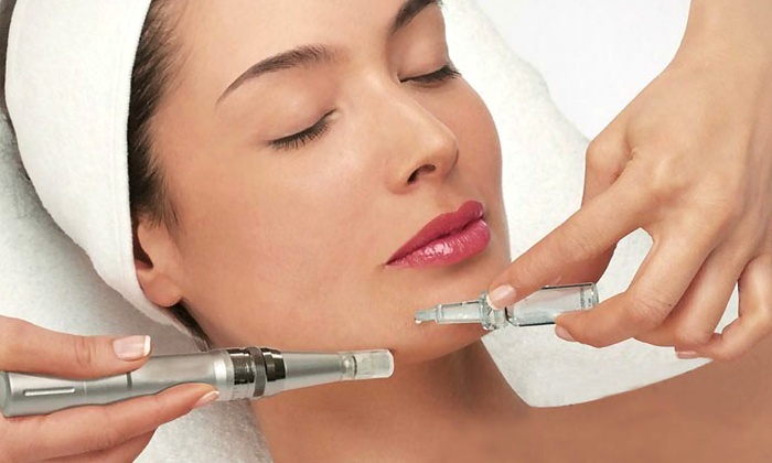 The Magic Of Microneedling Because Spa Facials Are Old News!