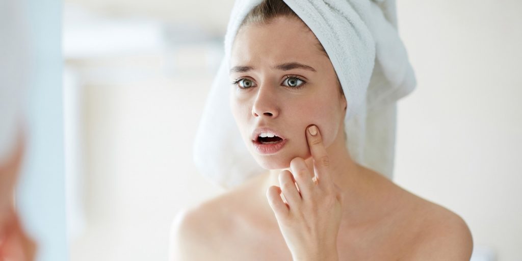 7 Ways to Get Rid of Breakouts Right In Time For Your Wedding!