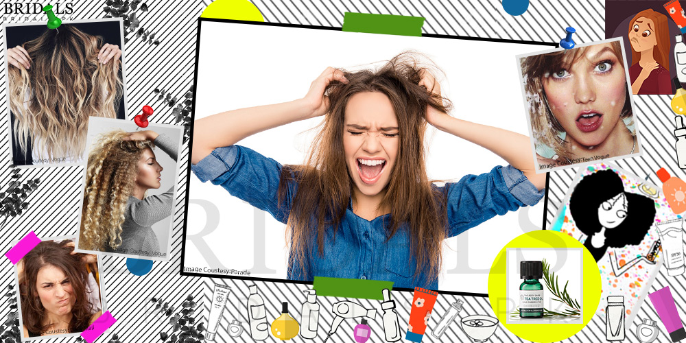 7 Tried And Tested Home Remedies For Fighting Dandruff This Fall